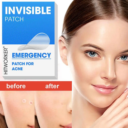 400-1200PCS Invisible Hydrocolloid Pimple Acne Patches Zit Spot Stickers Covering Zits Blemishes W Salicylic Acid & Tea Tree Oil