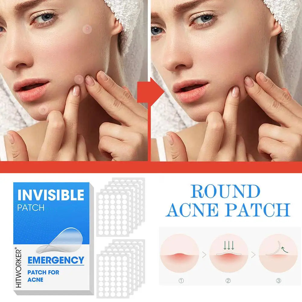 400-1200PCS Invisible Hydrocolloid Pimple Acne Patches Zit Spot Stickers Covering Zits Blemishes W Salicylic Acid & Tea Tree Oil